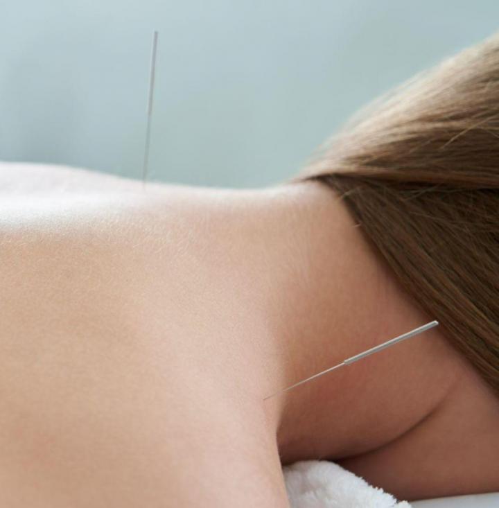 Soins d'acupuncture Les Coteaux