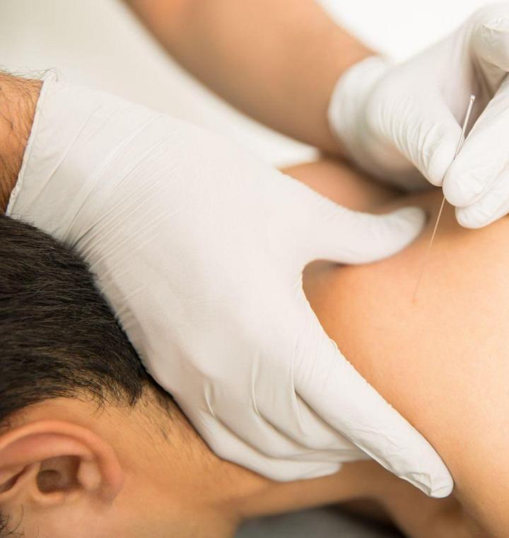 Acupuncture Les Coteaux